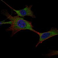 HK1 Antibody in Immunocytochemistry (ICC/IF)