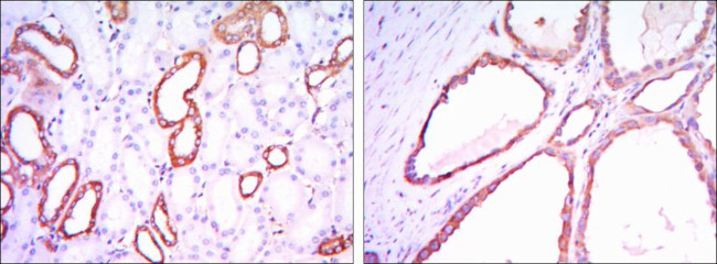 HK1 Antibody in Immunohistochemistry (Paraffin) (IHC (P))