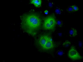 HK2 Antibody in Immunocytochemistry (ICC/IF)