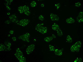 HK2 Antibody in Immunocytochemistry (ICC/IF)