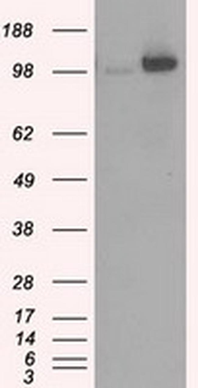 HK2 Antibody in Western Blot (WB)