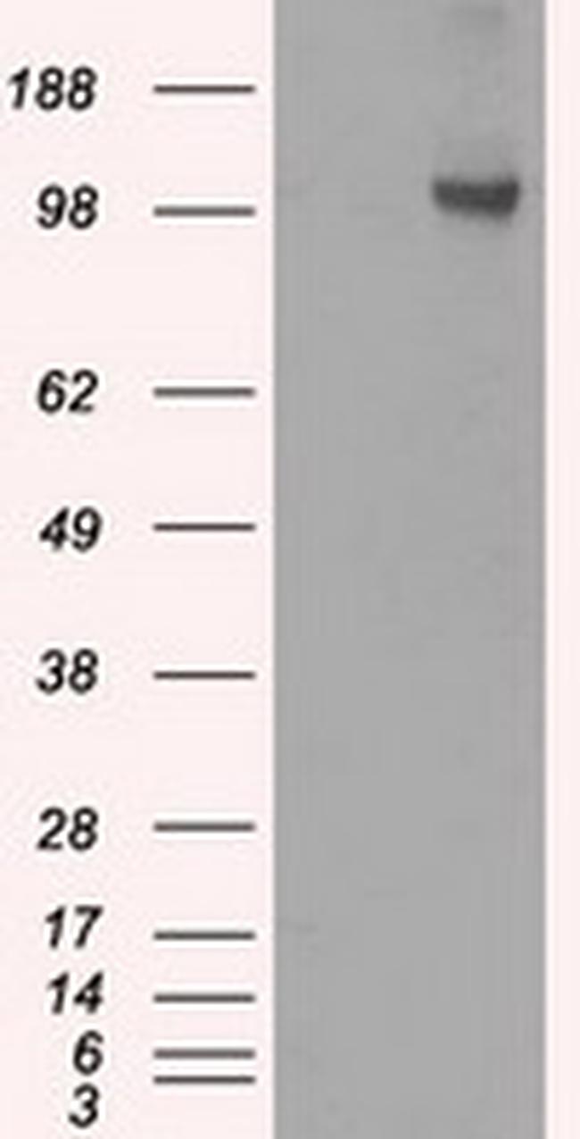 HK2 Antibody in Western Blot (WB)