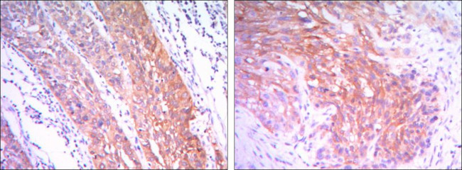 HK2 Antibody in Immunohistochemistry (Paraffin) (IHC (P))