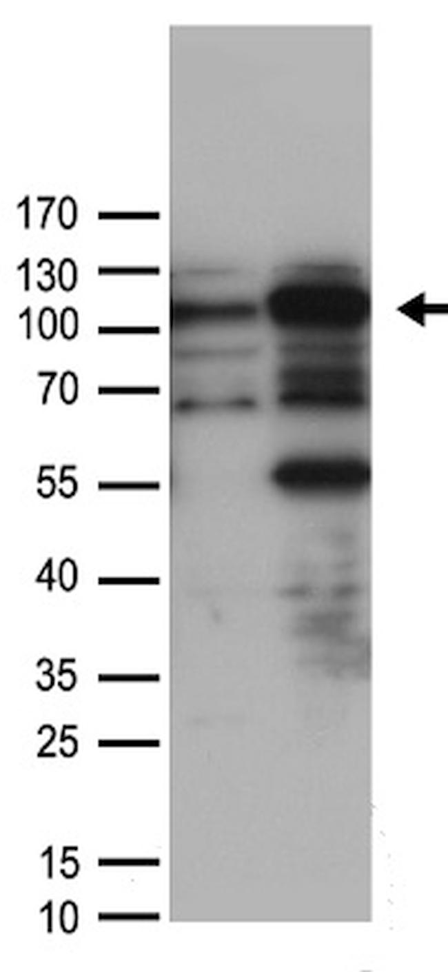 HLTF Antibody in Western Blot (WB)