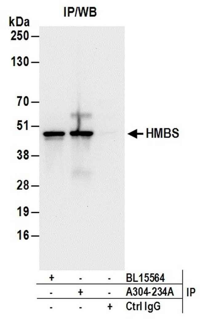 HMBS Antibody in Western Blot (WB)