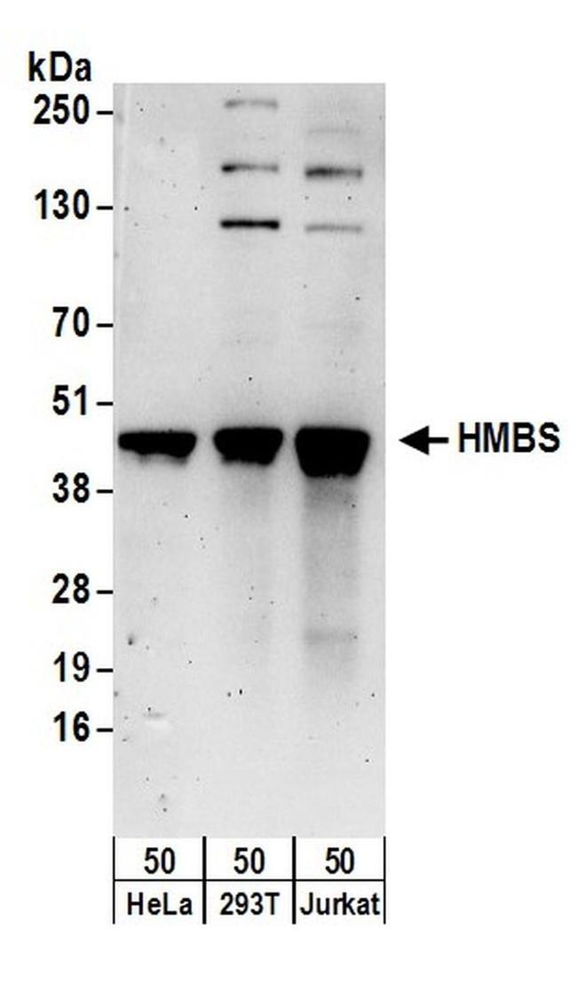 HMBS Antibody in Western Blot (WB)