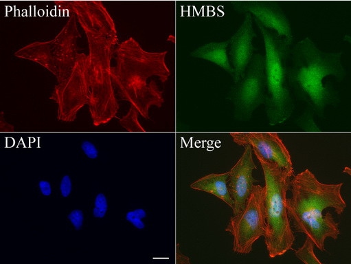 HMBS Antibody in Immunocytochemistry (ICC/IF)