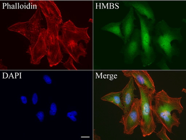 HMBS Antibody in Immunocytochemistry (ICC/IF)