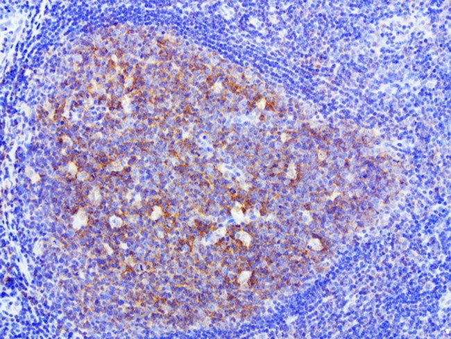 HMBS Antibody in Immunohistochemistry (Paraffin) (IHC (P))