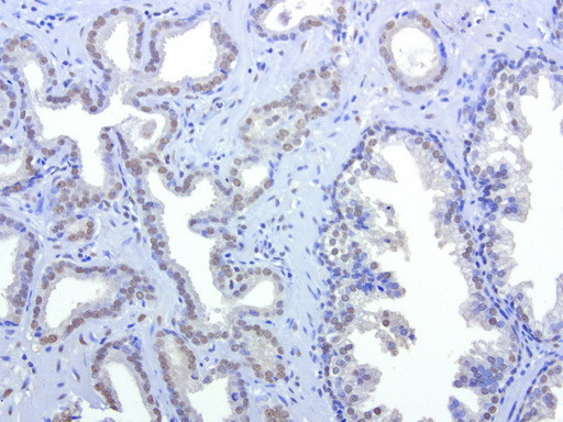 HMBS Antibody in Immunohistochemistry (Paraffin) (IHC (P))