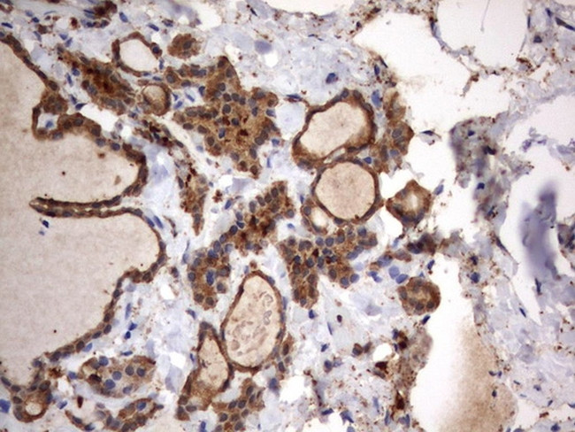 HMBS Antibody in Immunohistochemistry (Paraffin) (IHC (P))