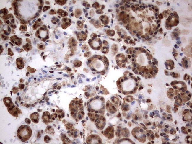 HMBS Antibody in Immunohistochemistry (Paraffin) (IHC (P))