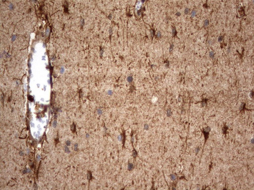 HMBS Antibody in Immunohistochemistry (Paraffin) (IHC (P))