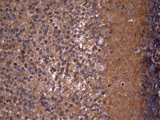 HMBS Antibody in Immunohistochemistry (Paraffin) (IHC (P))