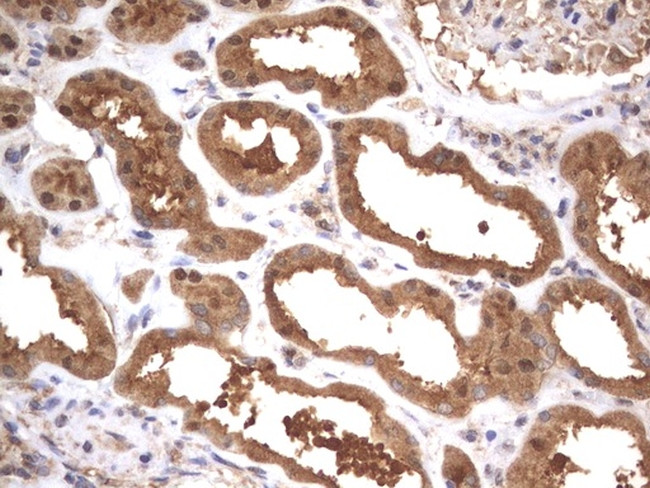 HMBS Antibody in Immunohistochemistry (Paraffin) (IHC (P))