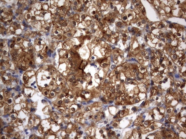 HMBS Antibody in Immunohistochemistry (Paraffin) (IHC (P))