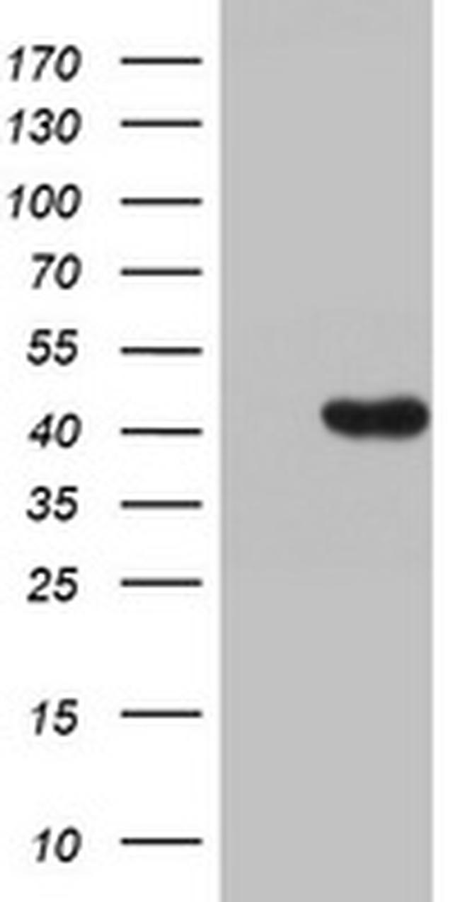 HMBS Antibody in Western Blot (WB)