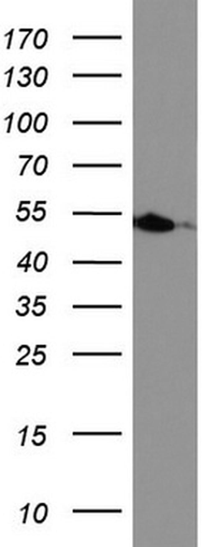 HMBS Antibody in Western Blot (WB)