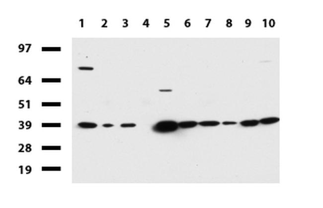 HMBS Antibody in Western Blot (WB)