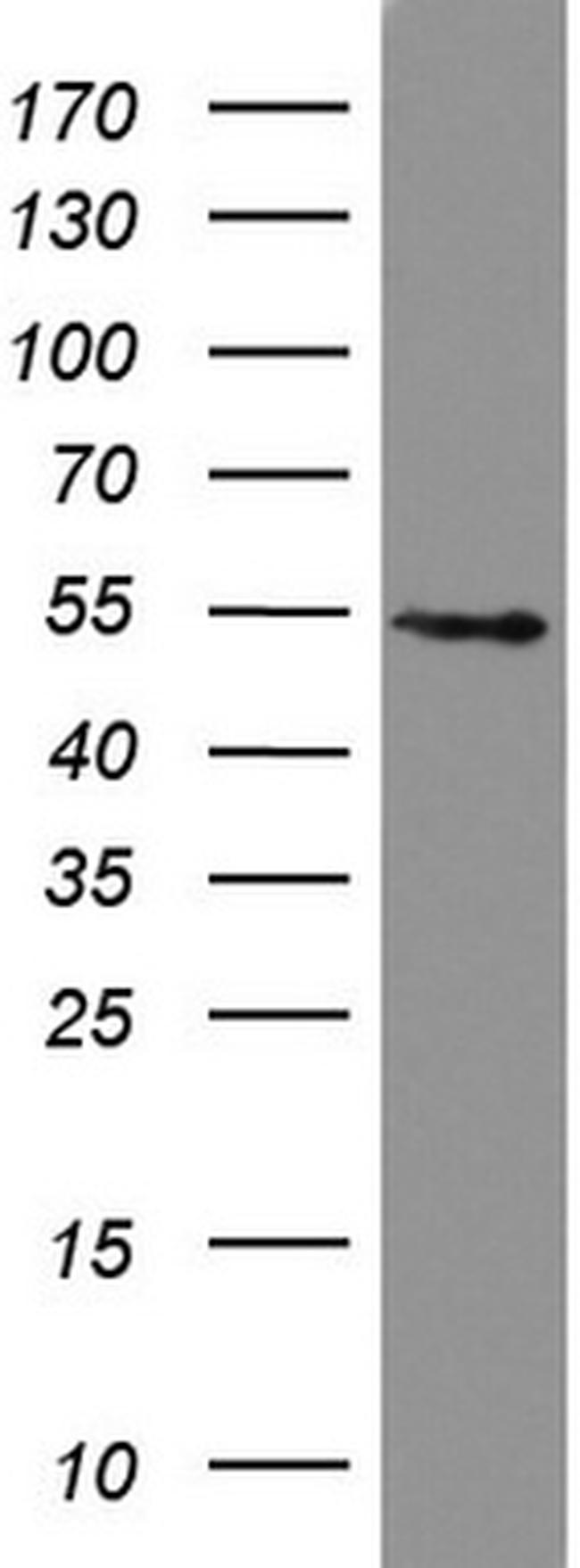 HMBS Antibody in Western Blot (WB)