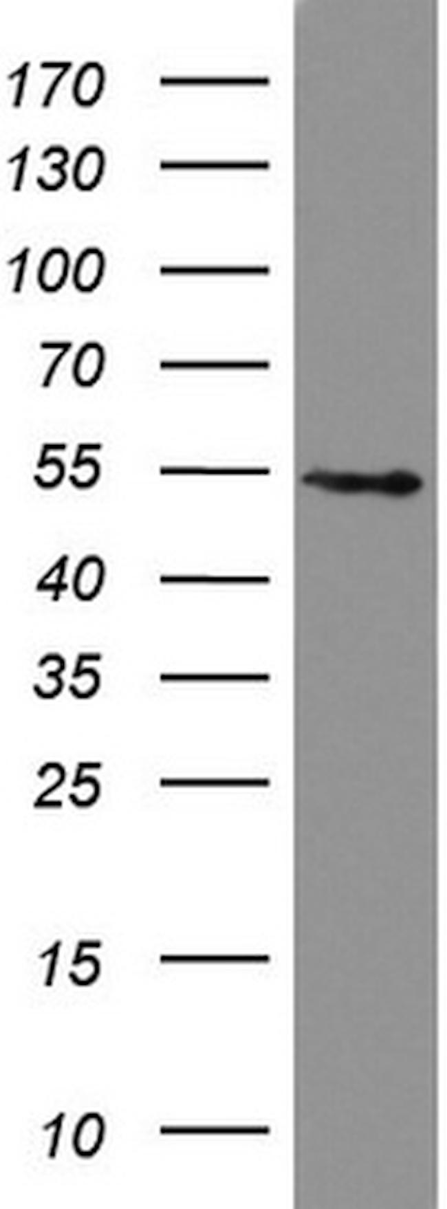 HMBS Antibody in Western Blot (WB)