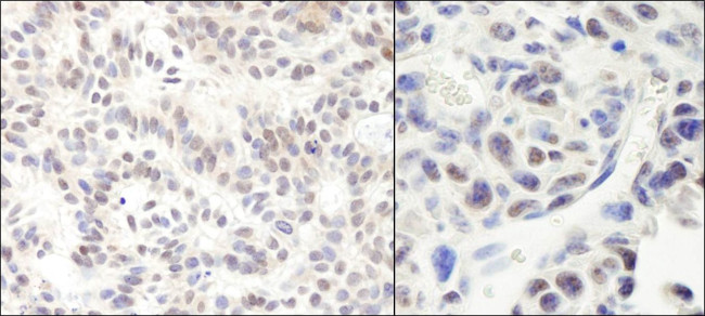 HMG2a Antibody in Immunohistochemistry (IHC)