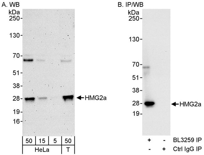 HMG2a Antibody in Western Blot (WB)