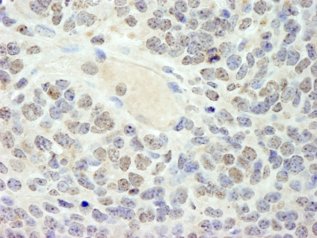 HMG2a Antibody in Immunohistochemistry (IHC)