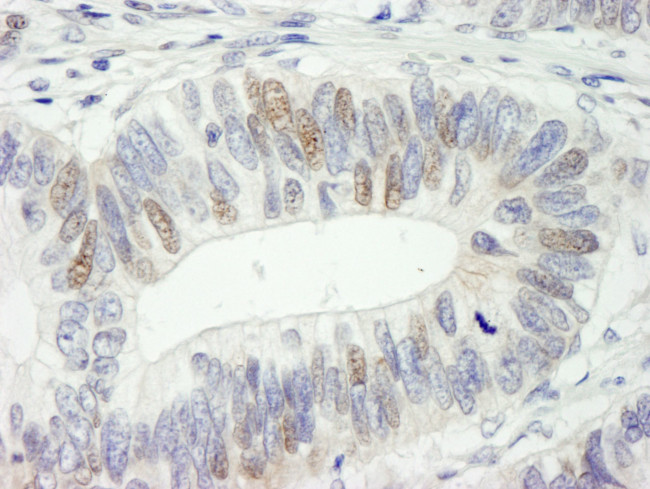 HMG2a Antibody in Immunohistochemistry (IHC)