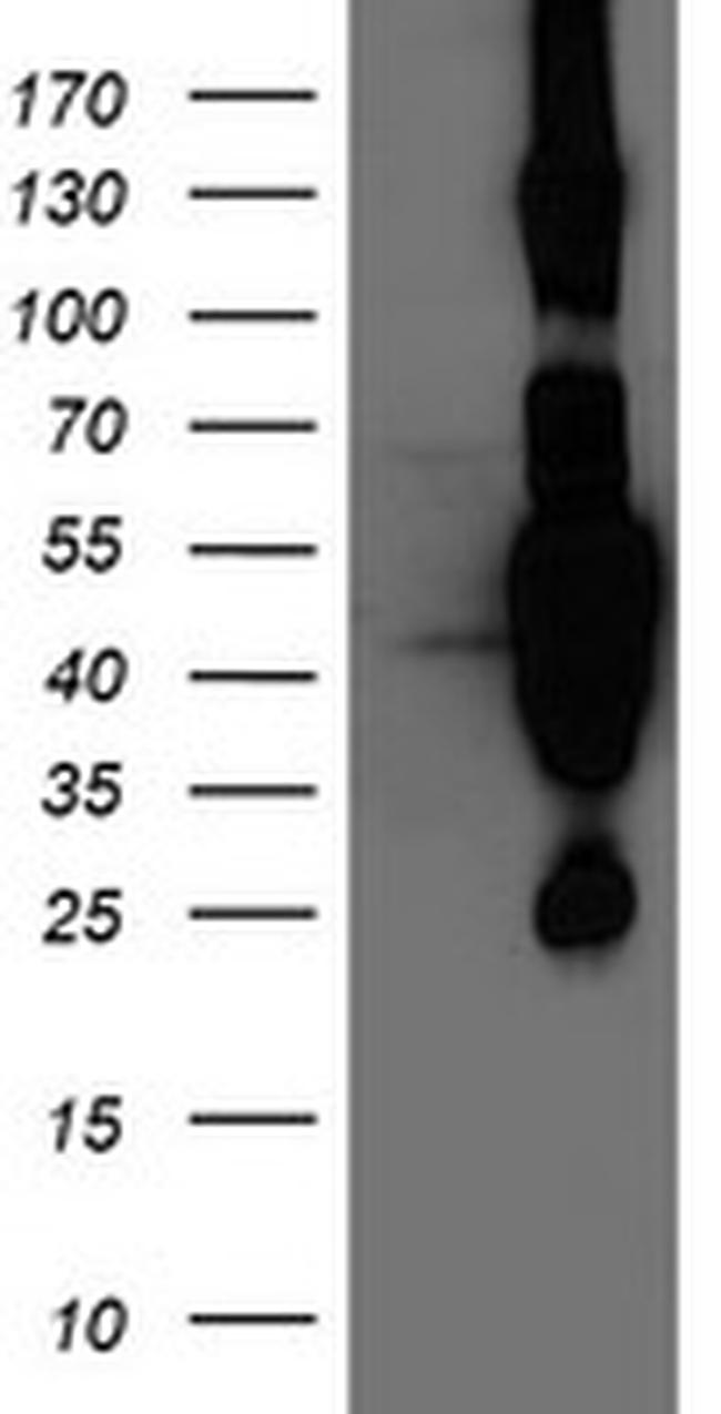 HMOX2 Antibody in Western Blot (WB)