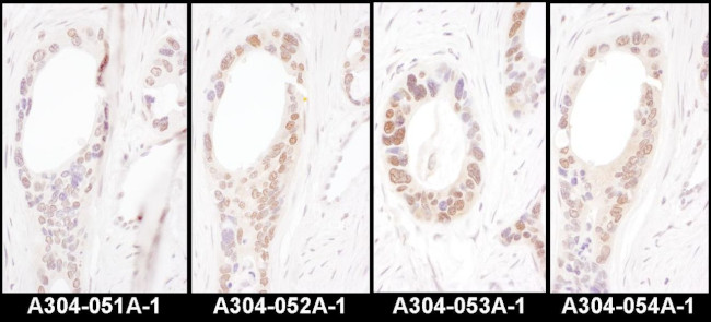 HNF1-alpha Antibody in Immunohistochemistry (IHC)