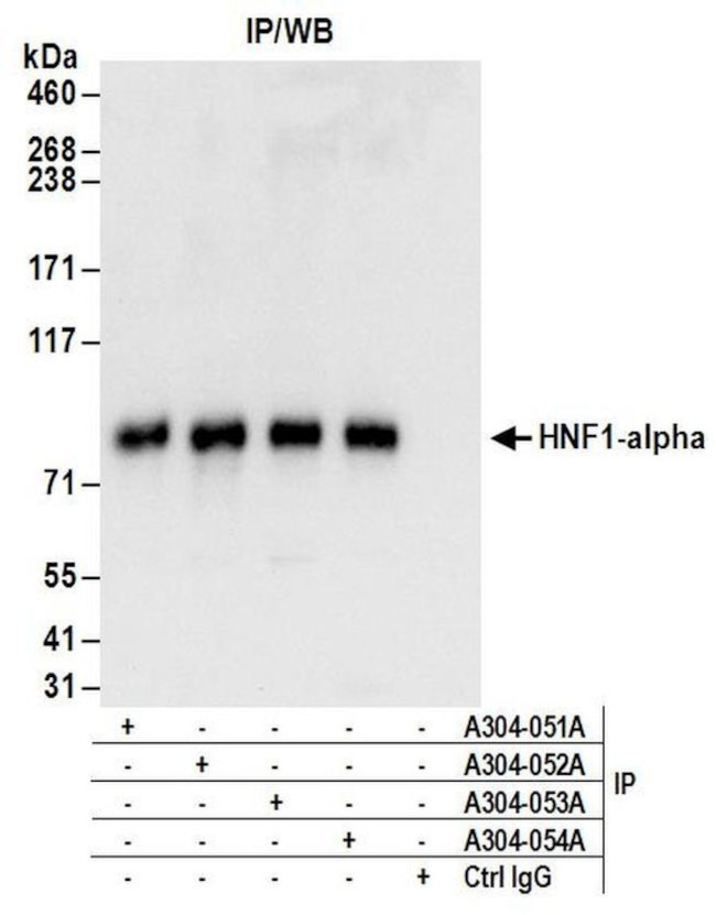 HNF1-alpha Antibody in Immunoprecipitation (IP)