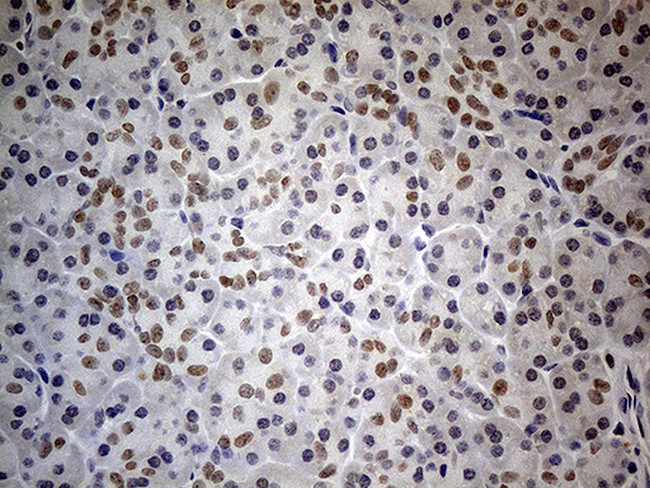 HNF1B Antibody in Immunohistochemistry (Paraffin) (IHC (P))