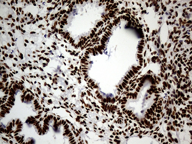 HNRNPH1 Antibody in Immunohistochemistry (Paraffin) (IHC (P))