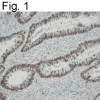 hnRNP K Antibody in Immunohistochemistry (IHC)