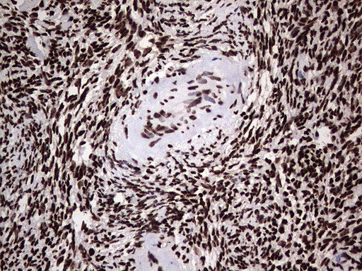 HNRNPL Antibody in Immunohistochemistry (Paraffin) (IHC (P))