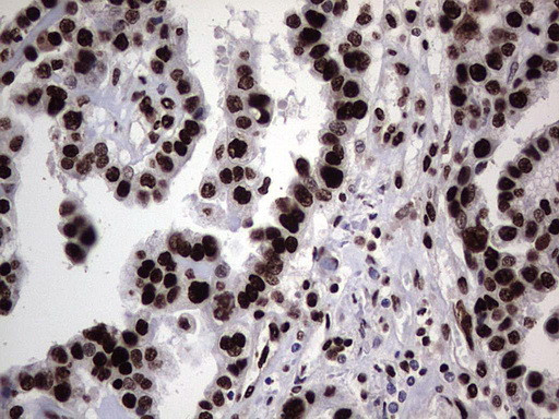 HNRNPL Antibody in Immunohistochemistry (Paraffin) (IHC (P))