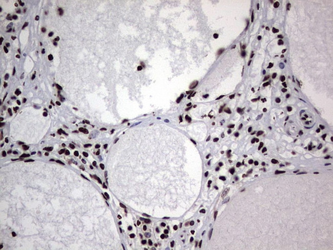 HNRNPL Antibody in Immunohistochemistry (Paraffin) (IHC (P))