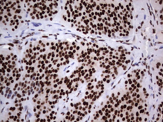 HNRNPL Antibody in Immunohistochemistry (Paraffin) (IHC (P))