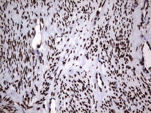 HNRNPL Antibody in Immunohistochemistry (Paraffin) (IHC (P))