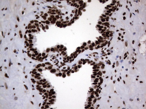 HNRNPL Antibody in Immunohistochemistry (Paraffin) (IHC (P))