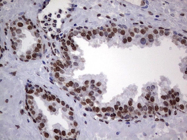 HNRNPL Antibody in Immunohistochemistry (Paraffin) (IHC (P))