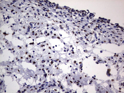 HNRNPL Antibody in Immunohistochemistry (Paraffin) (IHC (P))