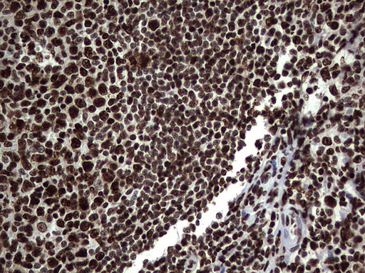 HNRNPL Antibody in Immunohistochemistry (Paraffin) (IHC (P))