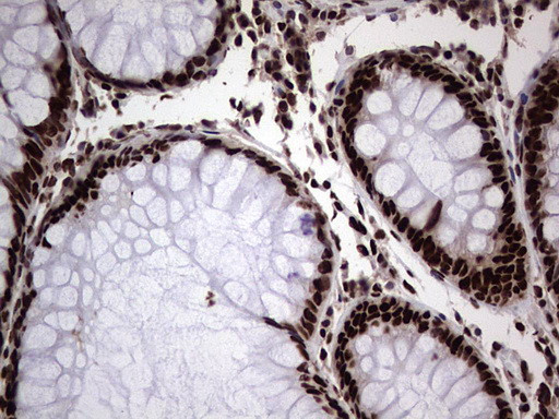 HNRNPL Antibody in Immunohistochemistry (Paraffin) (IHC (P))