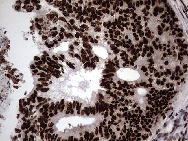 HNRNPL Antibody in Immunohistochemistry (Paraffin) (IHC (P))