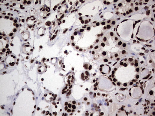 HNRNPL Antibody in Immunohistochemistry (Paraffin) (IHC (P))