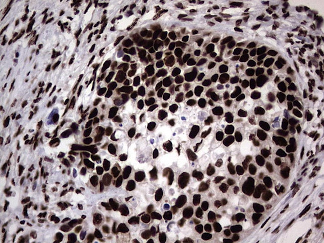 HNRNPL Antibody in Immunohistochemistry (Paraffin) (IHC (P))