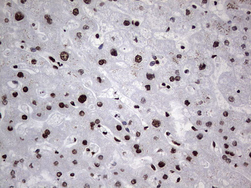 HNRNPL Antibody in Immunohistochemistry (Paraffin) (IHC (P))