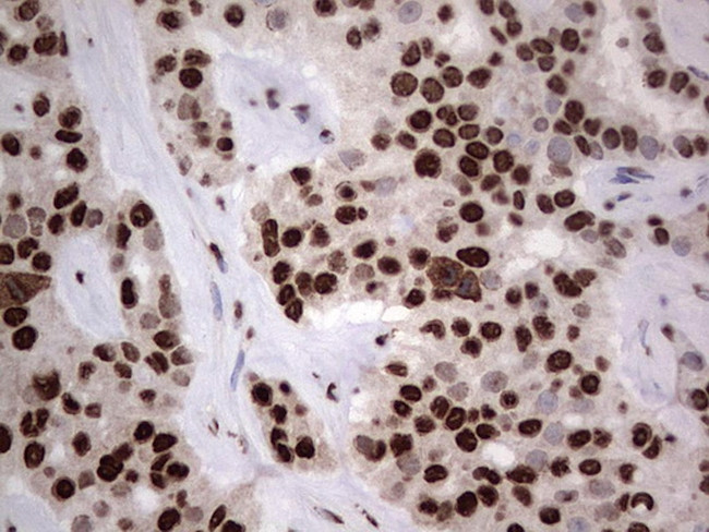 HNRNPL Antibody in Immunohistochemistry (Paraffin) (IHC (P))